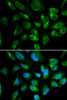 Immunofluorescence analysis of HepG2 cells using KIR2DL3 antibody (16-821) . Blue: DAPI for nuclear staining.