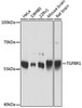 Western blot analysis of extracts of various cell lines, using TGFBR1 antibody (16-823) at 1:1000 dilution.<br/>Secondary antibody: HRP Goat Anti-Rabbit IgG (H+L) at 1:10000 dilution.<br/>Lysates/proteins: 25ug per lane.<br/>Blocking buffer: 3% nonfat dry milk in TBST.<br/>Detection: ECL Basic Kit.<br/>Exposure time: 30s.