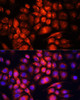 Immunofluorescence analysis of HeLa cells using UCP3 antibody (16-826) at dilution of 1:100. Blue: DAPI for nuclear staining.