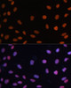 Western blot analysis of extracts of Jurkat cells, using Rb antibody (16-832) at 1:1000 dilution.<br/>Secondary antibody: HRP Goat Anti-Rabbit IgG (H+L) at 1:10000 dilution.<br/>Lysates/proteins: 25ug per lane.<br/>Blocking buffer: 3% nonfat dry milk in TBST.<br/>Detection: ECL Basic Kit.<br/>Exposure time: 90s.