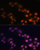 Immunofluorescence analysis of HeLa cells using WT1 antibody (16-833) at dilution of 1:100. Blue: DAPI for nuclear staining.