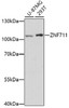 Western blot analysis of extracts of various cell lines, using ZNF711 antibody (16-834) at 1:1000 dilution.<br/>Secondary antibody: HRP Goat Anti-Rabbit IgG (H+L) at 1:10000 dilution.<br/>Lysates/proteins: 25ug per lane.<br/>Blocking buffer: 3% nonfat dry milk in TBST.<br/>Detection: ECL Enhanced Kit.<br/>Exposure time: 3min.