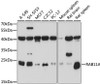 Western blot analysis of extracts of various cell lines, using RAB11A antibody (16-841) at 1:1000 dilution.<br/>Secondary antibody: HRP Goat Anti-Rabbit IgG (H+L) at 1:10000 dilution.<br/>Lysates/proteins: 25ug per lane.<br/>Blocking buffer: 3% nonfat dry milk in TBST.<br/>Detection: ECL Basic Kit.<br/>Exposure time: 15s.