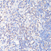 Immunohistochemistry of paraffin-embedded human appendix using CFL1 antibody (16-844) at dilution of 1:100 (40x lens) .