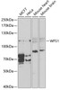 Western blot analysis of extracts of various cell lines, using WFS1 antibody (16-845) at 1:1000 dilution.<br/>Secondary antibody: HRP Goat Anti-Rabbit IgG (H+L) at 1:10000 dilution.<br/>Lysates/proteins: 25ug per lane.<br/>Blocking buffer: 3% nonfat dry milk in TBST.