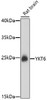 Western blot analysis of extracts of rat brain, using YKT6 antibody (16-858) at 1:1000 dilution.<br/>Secondary antibody: HRP Goat Anti-Rabbit IgG (H+L) at 1:10000 dilution.<br/>Lysates/proteins: 25ug per lane.<br/>Blocking buffer: 3% nonfat dry milk in TBST.<br/>Detection: ECL Basic Kit.<br/>Exposure time: 90s.