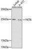Western blot analysis of extracts of various cell lines, using YKT6 antibody (16-859) at 1:1000 dilution.<br/>Secondary antibody: HRP Goat Anti-Rabbit IgG (H+L) at 1:10000 dilution.<br/>Lysates/proteins: 25ug per lane.<br/>Blocking buffer: 3% nonfat dry milk in TBST.<br/>Detection: ECL Basic Kit.<br/>Exposure time: 3min.