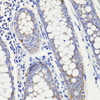 Immunohistochemistry of paraffin-embedded human colon using PDCD10 antibody (16-865) at dilution of 1:100 (40x lens) .