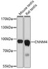 Western blot analysis of extracts of various cell lines, using CNNM4 antibody (16-872) at 1:1000 dilution.<br/>Secondary antibody: HRP Goat Anti-Rabbit IgG (H+L) at 1:10000 dilution.<br/>Lysates/proteins: 25ug per lane.<br/>Blocking buffer: 3% nonfat dry milk in TBST.<br/>Detection: ECL Basic Kit.<br/>Exposure time: 90s.