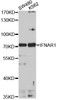 Western blot analysis of extracts of various cell lines, using IFNAR1 antibody (16-874) at 1:1000 dilution.<br/>Secondary antibody: HRP Goat Anti-Rabbit IgG (H+L) at 1:10000 dilution.<br/>Lysates/proteins: 25ug per lane.<br/>Blocking buffer: 3% nonfat dry milk in TBST.<br/>Detection: ECL Basic Kit.<br/>Exposure time: 90s.