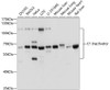 Western blot analysis of extracts of various cell lines, using C1 Inactivator antibody (16-878) at 1:1000 dilution.<br/>Secondary antibody: HRP Goat Anti-Rabbit IgG (H+L) at 1:10000 dilution.<br/>Lysates/proteins: 25ug per lane.<br/>Blocking buffer: 3% nonfat dry milk in TBST.<br/>Detection: ECL Basic Kit.<br/>Exposure time: 3s.