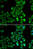 Immunofluorescence analysis of HeLa cells using DRD5 antibody (16-882) . Blue: DAPI for nuclear staining.