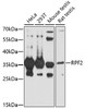 Western blot analysis of extracts of various cell lines, using RPF2 antibody (16-888) at 1:1000 dilution.<br/>Secondary antibody: HRP Goat Anti-Rabbit IgG (H+L) at 1:10000 dilution.<br/>Lysates/proteins: 25ug per lane.<br/>Blocking buffer: 3% nonfat dry milk in TBST.<br/>Detection: ECL Basic Kit.<br/>Exposure time: 90s.