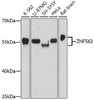 Western blot analysis of extracts of various cell lines, using ZNF563 antibody (16-898) at 1:1000 dilution.<br/>Secondary antibody: HRP Goat Anti-Rabbit IgG (H+L) at 1:10000 dilution.<br/>Lysates/proteins: 25ug per lane.<br/>Blocking buffer: 3% nonfat dry milk in TBST.<br/>Detection: ECL Basic Kit.<br/>Exposure time: 30s.