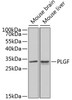 Western blot analysis of extracts of various cell lines, using PLGF antibody (16-900) at 1:1000 dilution.<br/>Secondary antibody: HRP Goat Anti-Rabbit IgG (H+L) at 1:10000 dilution.<br/>Lysates/proteins: 25ug per lane.<br/>Blocking buffer: 3% nonfat dry milk in TBST.<br/>Detection: ECL Basic Kit.