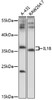 Western blot analysis of extracts of various cells, using IL1B antibody (16-928) at 1:1000 dilution.<br/>Secondary antibody: HRP Goat Anti-Rabbit IgG (H+L) at 1:10000 dilution.<br/>Lysates/proteins: 25ug per lane.<br/>Blocking buffer: 3% nonfat dry milk in TBST.<br/>Detection: ECL Basic Kit.<br/>Exposure time: 30s.