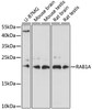 Western blot analysis of extracts of various cell lines, using RAB1A antibody (16-929) at 1:1000 dilution.<br/>Secondary antibody: HRP Goat Anti-Rabbit IgG (H+L) at 1:10000 dilution.<br/>Lysates/proteins: 25ug per lane.<br/>Blocking buffer: 3% nonfat dry milk in TBST.<br/>Detection: ECL Basic Kit.<br/>Exposure time: 30s.