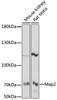 Western blot analysis of extracts of various cell lines, using Map2 antibody (16-938) at 1:1000 dilution.<br/>Secondary antibody: HRP Goat Anti-Rabbit IgG (H+L) at 1:10000 dilution.<br/>Lysates/proteins: 25ug per lane.<br/>Blocking buffer: 3% nonfat dry milk in TBST.<br/>Detection: ECL Basic Kit.<br/>Exposure time: 90s.