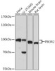 Western blot analysis of extracts of various cell lines, using PIK3R2 antibody (16-942) at 1:1000 dilution.<br/>Secondary antibody: HRP Goat Anti-Rabbit IgG (H+L) at 1:10000 dilution.<br/>Lysates/proteins: 25ug per lane.<br/>Blocking buffer: 3% nonfat dry milk in TBST.<br/>Detection: ECL Basic Kit.<br/>Exposure time: 90s.