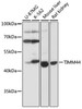 Western blot analysis of extracts of various cell lines, using TIMM44 antibody (16-946) at 1:1000 dilution.<br/>Secondary antibody: HRP Goat Anti-Rabbit IgG (H+L) at 1:10000 dilution.<br/>Lysates/proteins: 25ug per lane.<br/>Blocking buffer: 3% nonfat dry milk in TBST.<br/>Detection: ECL Basic Kit.<br/>Exposure time: 5s.