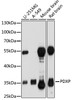 Western blot analysis of extracts of various cell lines, using PDXP antibody (16-949) at 1:1000 dilution.<br/>Secondary antibody: HRP Goat Anti-Rabbit IgG (H+L) at 1:10000 dilution.<br/>Lysates/proteins: 25ug per lane.<br/>Blocking buffer: 3% nonfat dry milk in TBST.<br/>Detection: ECL Basic Kit.<br/>Exposure time: 90s.