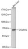 Western blot analysis of extracts of Rat liver, using COL9A2 antibody (16-951) at 1:1000 dilution.<br/>Secondary antibody: HRP Goat Anti-Rabbit IgG (H+L) at 1:10000 dilution.<br/>Lysates/proteins: 25ug per lane.<br/>Blocking buffer: 3% nonfat dry milk in TBST.<br/>Detection: ECL Basic Kit.<br/>Exposure time: 5min.