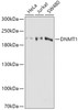 Western blot analysis of extracts of various cell lines, using DNMT1 antibody (16-953) at 1:1000 dilution.<br/>Secondary antibody: HRP Goat Anti-Rabbit IgG (H+L) at 1:10000 dilution.<br/>Lysates/proteins: 25ug per lane.<br/>Blocking buffer: 3% nonfat dry milk in TBST.<br/>Detection: ECL Basic Kit.<br/>Exposure time: 10s.