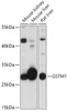 Western blot analysis of extracts of various cell lines, using GSTM1 antibody (16-958) at 1:1000 dilution.<br/>Secondary antibody: HRP Goat Anti-Rabbit IgG (H+L) at 1:10000 dilution.<br/>Lysates/proteins: 25ug per lane.<br/>Blocking buffer: 3% nonfat dry milk in TBST.<br/>Detection: ECL Basic Kit.<br/>Exposure time: 60s.