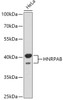 Western blot analysis of extracts of HeLa cells, using HNRPAB antibody (16-959) at 1:1000 dilution.<br/>Secondary antibody: HRP Goat Anti-Rabbit IgG (H+L) at 1:10000 dilution.<br/>Lysates/proteins: 25ug per lane.<br/>Blocking buffer: 3% nonfat dry milk in TBST.<br/>Detection: ECL Basic Kit.<br/>Exposure time: 30s.