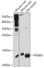 Western blot analysis of extracts of various cell lines, using PDE6G antibody (16-968) at 1:1000 dilution.<br/>Secondary antibody: HRP Goat Anti-Rabbit IgG (H+L) at 1:10000 dilution.<br/>Lysates/proteins: 25ug per lane.<br/>Blocking buffer: 3% nonfat dry milk in TBST.<br/>Detection: ECL Basic Kit.<br/>Exposure time: 30s.