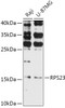 Western blot analysis of extracts of various cell lines, using RPS23 antibody (16-972) at 1:1000 dilution.<br/>Secondary antibody: HRP Goat Anti-Rabbit IgG (H+L) at 1:10000 dilution.<br/>Lysates/proteins: 25ug per lane.<br/>Blocking buffer: 3% nonfat dry milk in TBST.<br/>Detection: ECL Basic Kit.<br/>Exposure time: 90s.