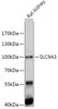 Western blot analysis of extracts of Rat kidney, using SLC9A3 antibody (16-975) at 1:1000 dilution.<br/>Secondary antibody: HRP Goat Anti-Rabbit IgG (H+L) at 1:10000 dilution.<br/>Lysates/proteins: 25ug per lane.<br/>Blocking buffer: 3% nonfat dry milk in TBST.<br/>Detection: ECL Enhanced Kit.<br/>Exposure time: 120s.