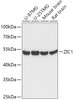 Western blot analysis of extracts of various cell lines, using ZIC1 antibody (16-982) at 1:1000 dilution.<br/>Secondary antibody: HRP Goat Anti-Rabbit IgG (H+L) at 1:10000 dilution.<br/>Lysates/proteins: 25ug per lane.<br/>Blocking buffer: 3% nonfat dry milk in TBST.<br/>Detection: ECL Basic Kit.<br/>Exposure time: 30s.