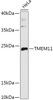 Western blot analysis of extracts of HeLa cells, using TMEM11 antibody (16-990) at 1:1000 dilution.<br/>Secondary antibody: HRP Goat Anti-Rabbit IgG (H+L) at 1:10000 dilution.<br/>Lysates/proteins: 25ug per lane.<br/>Blocking buffer: 3% nonfat dry milk in TBST.<br/>Detection: ECL Basic Kit.<br/>Exposure time: 3min.