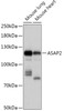 Western blot analysis of extracts of various cell lines, using ASAP2 antibody (16-991) at 1:1000 dilution.<br/>Secondary antibody: HRP Goat Anti-Rabbit IgG (H+L) at 1:10000 dilution.<br/>Lysates/proteins: 25ug per lane.<br/>Blocking buffer: 3% nonfat dry milk in TBST.<br/>Detection: ECL Basic Kit.<br/>Exposure time: 10s.