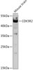 Western blot analysis of extracts of Mouse brain, using CDK5R2 antibody (16-993) at 1:1000 dilution.<br/>Secondary antibody: HRP Goat Anti-Rabbit IgG (H+L) at 1:10000 dilution.<br/>Lysates/proteins: 25ug per lane.<br/>Blocking buffer: 3% nonfat dry milk in TBST.<br/>Detection: ECL Basic Kit.<br/>Exposure time: 90s.