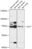 Western blot analysis of extracts of various cell lines, using SLU7 antibody (18-004) at 1:1000 dilution.<br/>Secondary antibody: HRP Goat Anti-Rabbit IgG (H+L) at 1:10000 dilution.<br/>Lysates/proteins: 25ug per lane.<br/>Blocking buffer: 3% nonfat dry milk in TBST.<br/>Detection: ECL Basic Kit.<br/>Exposure time: 30s.