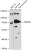 Western blot analysis of extracts of various cell lines, using ZNF460 antibody (18-011) at 1:1000 dilution.<br/>Secondary antibody: HRP Goat Anti-Rabbit IgG (H+L) at 1:10000 dilution.<br/>Lysates/proteins: 25ug per lane.<br/>Blocking buffer: 3% nonfat dry milk in TBST.<br/>Detection: ECL Basic Kit.<br/>Exposure time: 30s.