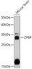 Western blot analysis of extracts of Mouse brain, using ZPBP antibody (18-013) at 1:1000 dilution.<br/>Secondary antibody: HRP Goat Anti-Rabbit IgG (H+L) at 1:10000 dilution.<br/>Lysates/proteins: 25ug per lane.<br/>Blocking buffer: 3% nonfat dry milk in TBST.<br/>Detection: ECL Basic Kit.<br/>Exposure time: 30s.