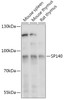 Western blot analysis of extracts of various cell lines, using SP140 antibody (18-016) at 1:1000 dilution.<br/>Secondary antibody: HRP Goat Anti-Rabbit IgG (H+L) at 1:10000 dilution.<br/>Lysates/proteins: 25ug per lane.<br/>Blocking buffer: 3% nonfat dry milk in TBST.<br/>Detection: ECL Basic Kit.<br/>Exposure time: 30s.