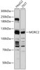 Western blot analysis of extracts of various cell lines, using MORC2 antibody (18-020) at 1:1000 dilution.<br/>Secondary antibody: HRP Goat Anti-Rabbit IgG (H+L) at 1:10000 dilution.<br/>Lysates/proteins: 25ug per lane.<br/>Blocking buffer: 3% nonfat dry milk in TBST.<br/>Detection: ECL Basic Kit.<br/>Exposure time: 5s.