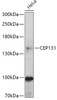 Western blot analysis of extracts of HeLa cells, using CEP131 antibody (18-025) at 1:1000 dilution.<br/>Secondary antibody: HRP Goat Anti-Rabbit IgG (H+L) at 1:10000 dilution.<br/>Lysates/proteins: 25ug per lane.<br/>Blocking buffer: 3% nonfat dry milk in TBST.<br/>Detection: ECL Basic Kit.<br/>Exposure time: 60s.