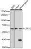 Western blot analysis of extracts of various cell lines, using USP22 antibody (18-032) at 1:1000 dilution.<br/>Secondary antibody: HRP Goat Anti-Rabbit IgG (H+L) at 1:10000 dilution.<br/>Lysates/proteins: 25ug per lane.<br/>Blocking buffer: 3% nonfat dry milk in TBST.<br/>Detection: ECL Basic Kit.<br/>Exposure time: 5min.