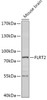 Western blot analysis of extracts of Mouse brain, using FLRT2 antibody (18-034) at 1:1000 dilution.<br/>Secondary antibody: HRP Goat Anti-Rabbit IgG (H+L) at 1:10000 dilution.<br/>Lysates/proteins: 25ug per lane.<br/>Blocking buffer: 3% nonfat dry milk in TBST.<br/>Detection: ECL Basic Kit.<br/>Exposure time: 90s.