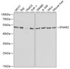 Western blot analysis of extracts of various cell lines, using IFNAR2 antibody (18-046) at 1:1000 dilution.<br/>Secondary antibody: HRP Goat Anti-Rabbit IgG (H+L) at 1:10000 dilution.<br/>Lysates/proteins: 25ug per lane.<br/>Blocking buffer: 3% nonfat dry milk in TBST.