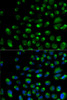 Immunofluorescence analysis of U2OS cells using IFNAR2 antibody (18-046) . Blue: DAPI for nuclear staining.