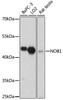 Western blot analysis of extracts of various cell lines, using NOB1 antibody (18-047) at 1:1000 dilution.<br/>Secondary antibody: HRP Goat Anti-Rabbit IgG (H+L) at 1:10000 dilution.<br/>Lysates/proteins: 25ug per lane.<br/>Blocking buffer: 3% nonfat dry milk in TBST.<br/>Detection: ECL Basic Kit.<br/>Exposure time: 30s.