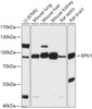 Western blot analysis of extracts of various cell lines, using EPN1 antibody (18-049) at 1:1000 dilution.<br/>Secondary antibody: HRP Goat Anti-Rabbit IgG (H+L) at 1:10000 dilution.<br/>Lysates/proteins: 25ug per lane.<br/>Blocking buffer: 3% nonfat dry milk in TBST.<br/>Detection: ECL Basic Kit.<br/>Exposure time: 15s.
