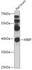 Western blot analysis of extracts of Rat brain, using MBIP antibody (18-057) at 1:1000 dilution.<br/>Secondary antibody: HRP Goat Anti-Rabbit IgG (H+L) at 1:10000 dilution.<br/>Lysates/proteins: 25ug per lane.<br/>Blocking buffer: 3% nonfat dry milk in TBST.<br/>Detection: ECL Basic Kit.<br/>Exposure time: 15s.