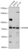 Western blot analysis of extracts of various cell lines, using MTMR8 antibody (18-072) at 1:1000 dilution.<br/>Secondary antibody: HRP Goat Anti-Rabbit IgG (H+L) at 1:10000 dilution.<br/>Lysates/proteins: 25ug per lane.<br/>Blocking buffer: 3% nonfat dry milk in TBST.<br/>Detection: ECL Basic Kit.<br/>Exposure time: 10s.